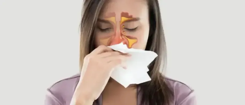 Woman holding a tissue to her nose with an illustration of the sinuses